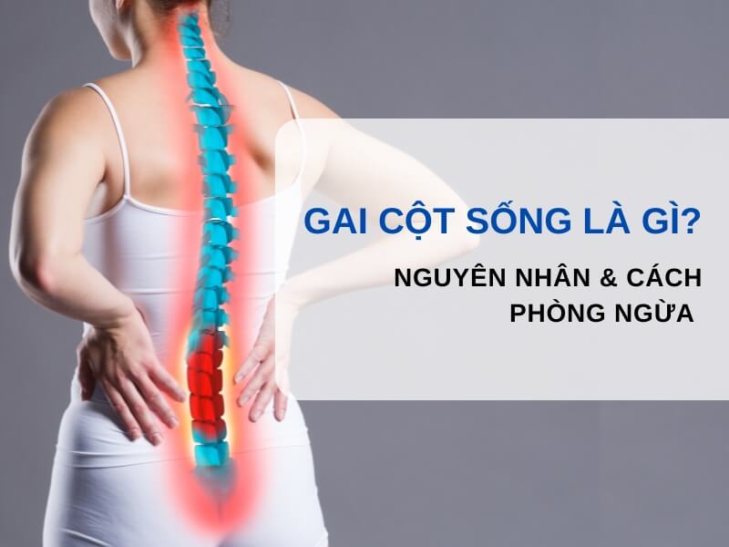 Bệnh cột sống là gì?