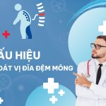 5+ Dấu Hiệu Thoát Vị Đĩa Đệm Mông Không Nên Chủ Quan