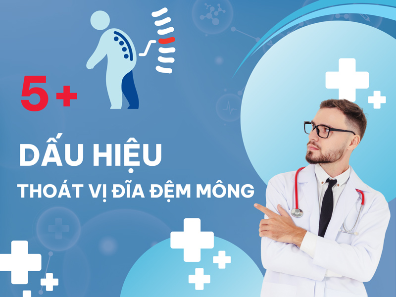 5+ Dấu Hiệu Thoát Vị Đĩa Đệm Mông Không Nên Chủ Quan