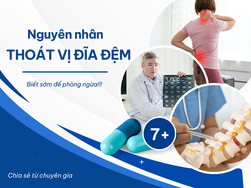 7 Nguyên Nhân Thoát Vị Đĩa Đệm - Biết Để Phòng Ngừa