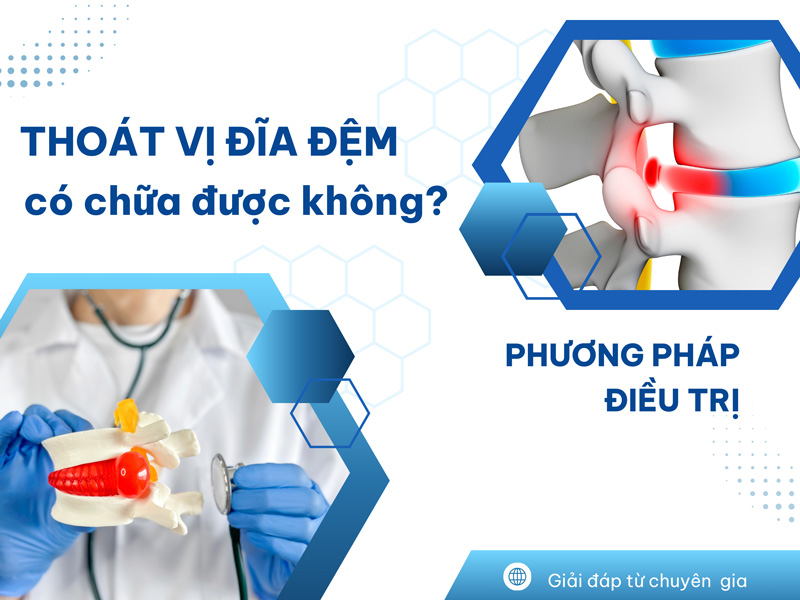 Thoát Vị Đĩa Đệm Có Chữa Được Không? Phương Pháp Điều Trị