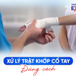 Trật Khớp Cổ Tay Phải Làm Sao? Cách Nắn Khớp Cổ Tay
